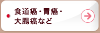 食道癌・胃癌・大腸癌など	