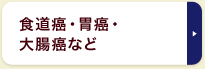 食道癌・胃癌・大腸癌など	